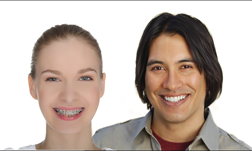 How to Choose&ndash;Braces vs Invisalign